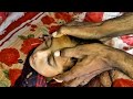 ASMR Head Massage VIP Experience 💆♂️ Ultimate Relaxing Sounds for Deep Sleep & Stress Relief