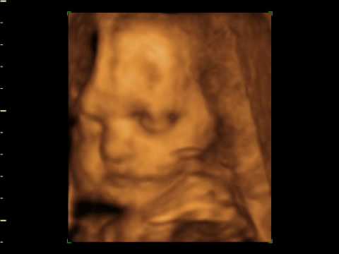 matty healy Baby of kelly and matt