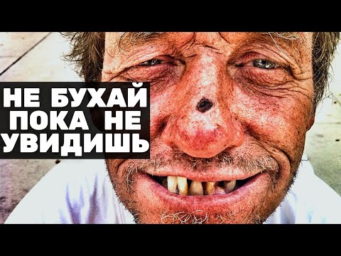 ✅ Как я БРОСИЛ пить САМ - Как бросить пить и начать трезвую жизнь самостоятельно