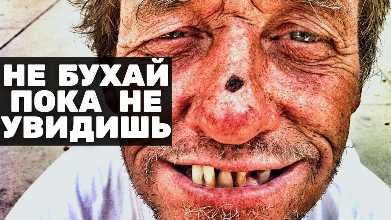 ✅ Как я БРОСИЛ пить САМ - Как бросить пить и начать трезвую жизнь самостоятельно