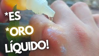 Como cicatrizar heridas de forma natural | Curar heridas, desinfectar heridas | ACEITE DE COPAIBA