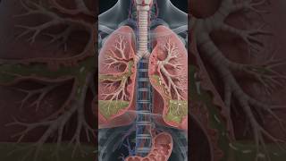 Bronchiectasis 😮💨|| #nursing #youtubeshorts #viralshorts #yotube #respiratorysystem #bronchiectasis