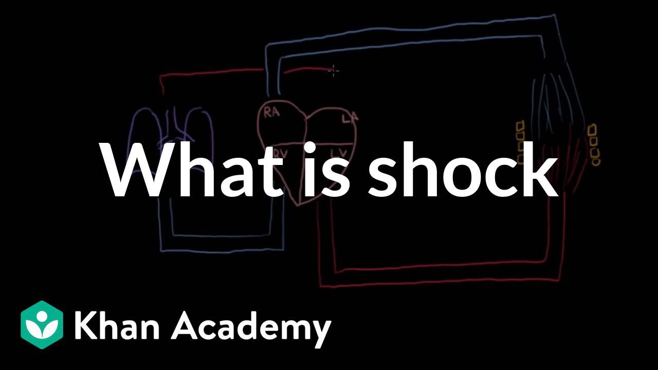 4 Types Of Shock Chart