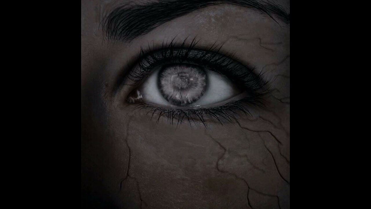 Анчанчу и Агропельтер