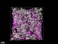 JID April 2023 Cover: Vimentin+ Cells and Extracellular Matrix in Human Dermis