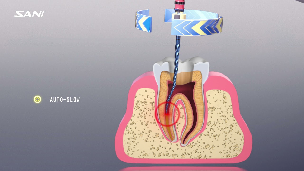 SANI Endo Motor YouTube