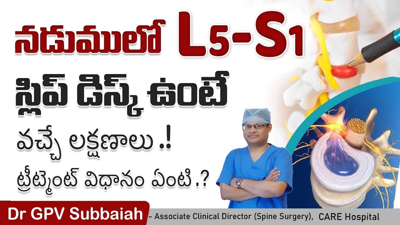 L5-S1 disc prolapse symptoms, diagnosis & treatment | Health video | Dr GPV Subbaiah