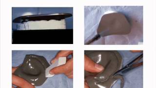 Etapes De Réalisation Dun Porte Empreinte Individuel Pei En True Base