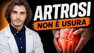 Artrosi: le 4 cause che nessuno ti spiega — e cosa fare davvero Artrosi: le 4 cause che nessuno ti spiega — e cosa fare davvero