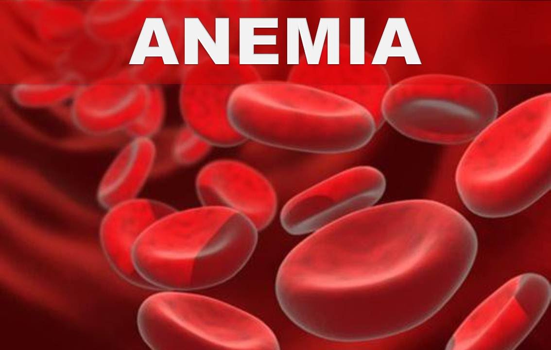 remedios naturales para la artritis ☞ 5 súper alimentos para combatir la anemia en pocas semanas