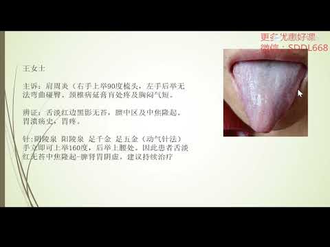 張菁蓉零基礎學舌診42  郭氏舌診觀察內容