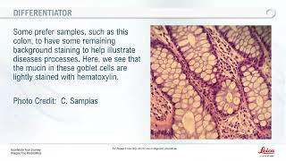 Fundamentals of Hematoxylin and Eosin Staining