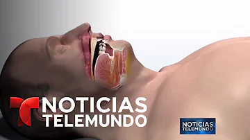 ¿Qué ocurre si tu CPAP se queda sin agua?