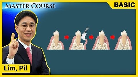 [Master Course Season2 - BASIC] Preview of Guide bone Regeneration GBR