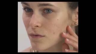 Dermacol Make-Up Cover - Aknelerinizden Kurtulun