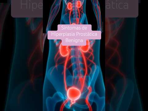 ✨Síntomas de Hiperplasia Prostatica Benigna - Medicina en la red 💊 #medicinaenlared #prostata