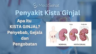 KISTA GINJAL - Penyebab, Gejala dan Cara Mengobati #berobatkepenang #kista #kistaginjal #medisehat