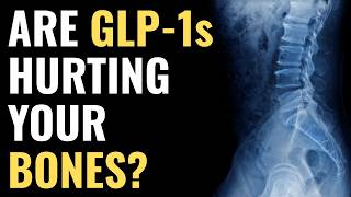Are GLP-1s Causing Bone Loss? Ozempic, Wegovy & Zepbound — What the Research Actually Shows