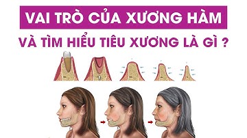 Ảnh Hưởng Cực Nghiêm Trọng Tiêu xương hàm | Vai trò của xương hàm và tìm hiểu tiêu xương là gì?