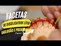 FACETAS COM DISSILICATO DE LÍTIO INCLUSÃO EM PRENSAGEM PARTE 01