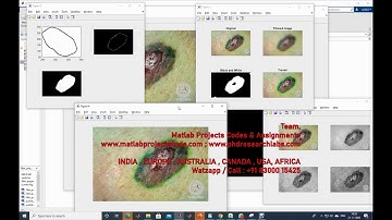 SKIN LESION IMAGE SEGMENTATION BOUNDARY DETECTION AND EDGE DETECTION WITH FILTERING