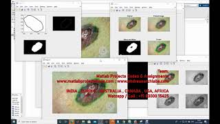 SKIN LESION IMAGE SEGMENTATION BOUNDARY DETECTION AND EDGE DETECTION WITH FILTERING