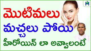 మొటిమలు మచ్చలు పోయి హీరోయిన్ లా అవ్వాలంటే | Dr Manthena Satyanarayana Raju | HealthMantra