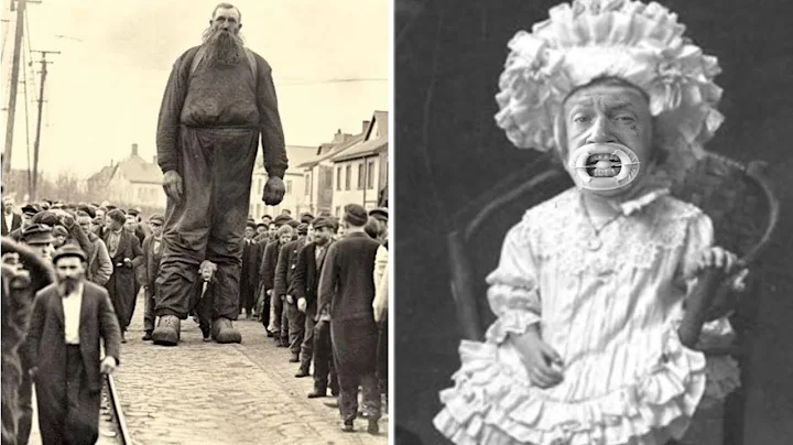 15 Most Unusual Circus Freaks Ever Recorded