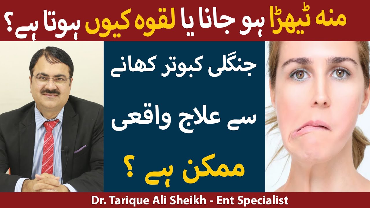 Laqwa Ka Ilaj Facial Paralysis Treatment In Urdu/Hindi, 49 OFF