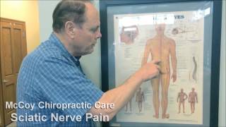 Ask Dr McCoy: What is Sciatica?