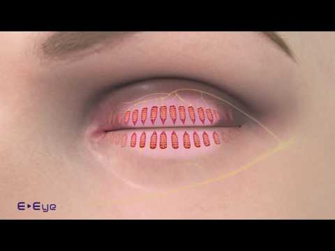E EYE - Operating mechanism of Dry Eye treatment - GB