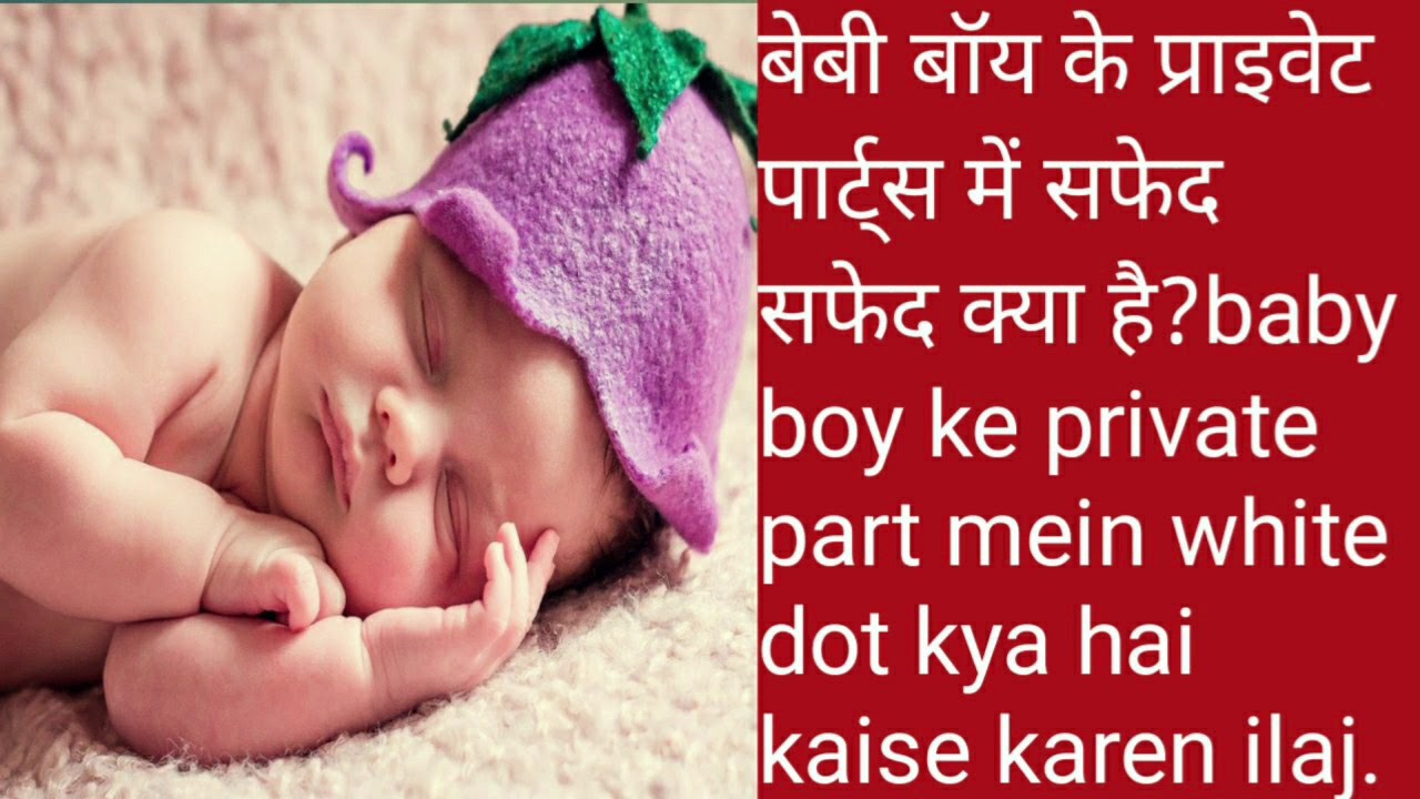 बेबी बॉय के प्राइवेट पार्ट्स में सफेद सफेद क्या है?baby boy ke private
