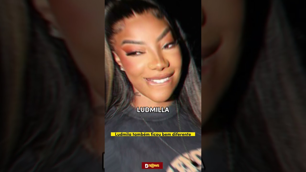 Cirurgia plástica: confira o “antes e depois” dos famosos