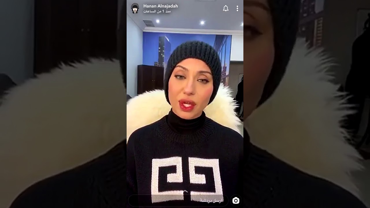 تأثر حنان النجادة في حديثها عن شفايفها 💔