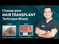 Choose your hair transplant technique wisely dhi india