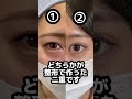 【二重整形】どちらかが整形で作った二重です★ #shorts