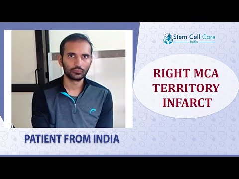 Patient — Right MCA Territory Infarct