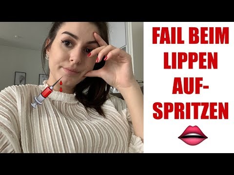 Lippen aufspritzen FAIL 😭