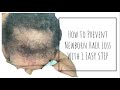 HOW TO PREVENT NEWBORN HAIR LOSS IN 1 EASY STEP