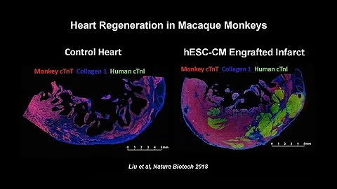 From COVID-19 to Heart Regeneration: The Pluripote...
