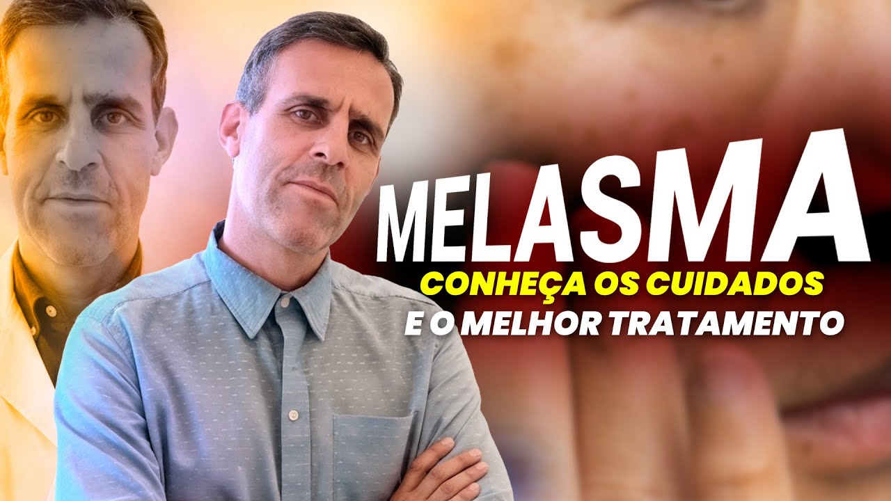 Melasma. Conheça os cuidados e o
