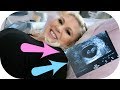 8 Week Baby Scan with Zoe! | MOTHERHOOD