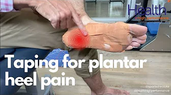 Taping for plantar heel pain & plantar fasciitis | Sports Chiropractor Melbourne