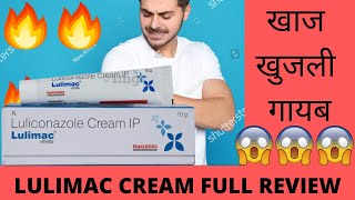 Lulimac Cream Review Fungal-Free Fiesta ललमक करम - खतम कर फगल सकट