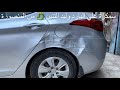 كيفية اصلاح الحوداث علي البارد بدون دهان وليد التنين سيارةالنترا 2012 Bumper Repair Without Paint 