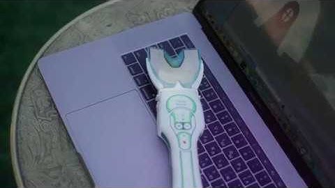 T-Scan Digital occlusal analysis and orthodontics