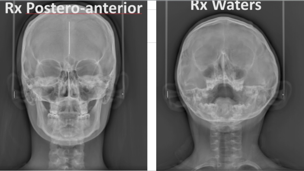 Radiografías Extraorales