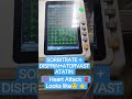 👉💯Heart Attack Looks like🫀#iillss #doctor #cardiacarrest #yt #neet #ytshorts #viralreels #viral #ecg