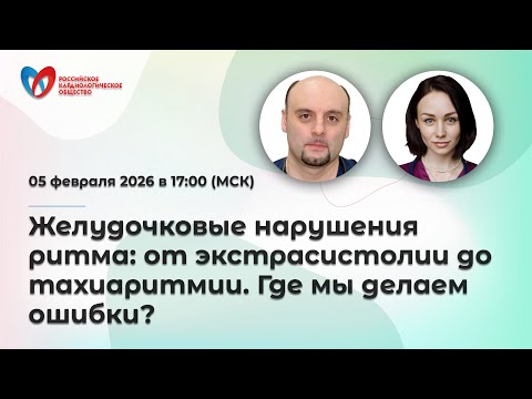 Желудочковые нарушения ритма: от экстрасистолии до тахиаритмии. Где мы делаем ошибки?