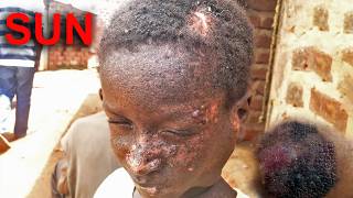 Avoid SUN EXPOSURE To Survive This